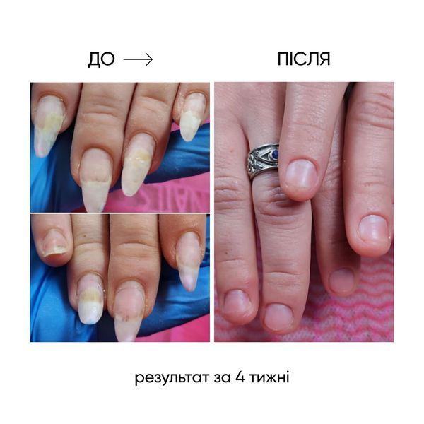NAILSOFTHEDAY ONISTOP &ndash; регенеруюча олія проти оніхолізису, 15 мл 4821454056414 фото