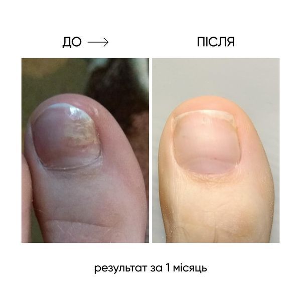 NAILSOFTHEDAY ONISTOP &ndash; регенеруюча олія проти оніхолізису, 15 мл 4821454056414 фото