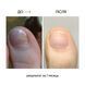 NAILSOFTHEDAY ONISTOP &ndash; регенеруюча олія проти оніхолізису, 15 мл 4821454056414 фото 3